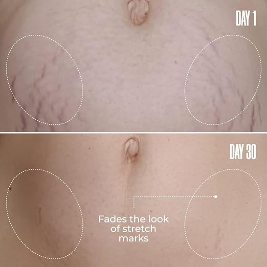 Belly Firming Cream