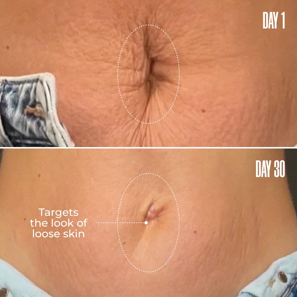 Belly Firming Cream