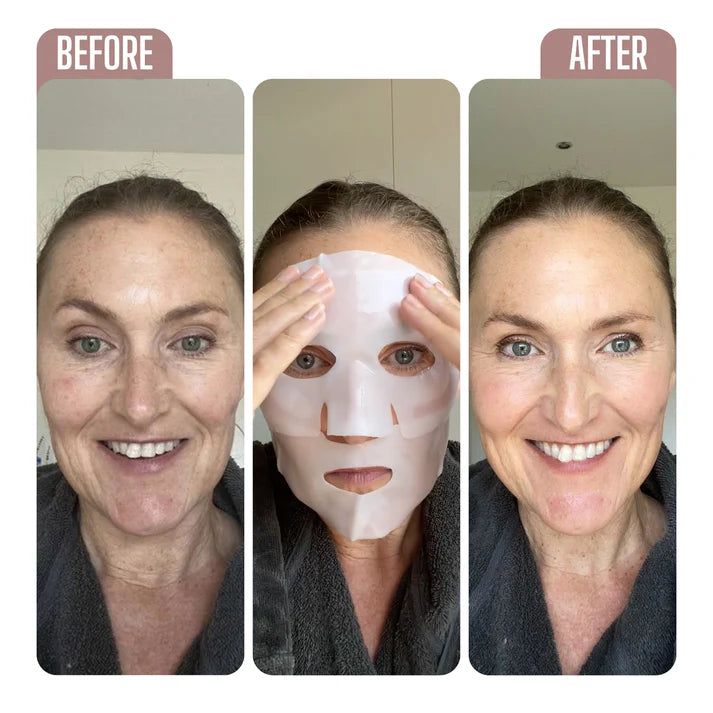 Spruka Bio-Collagen Mask 8 4 16