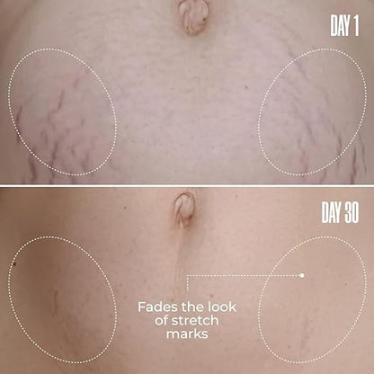 Belly Firming Cream